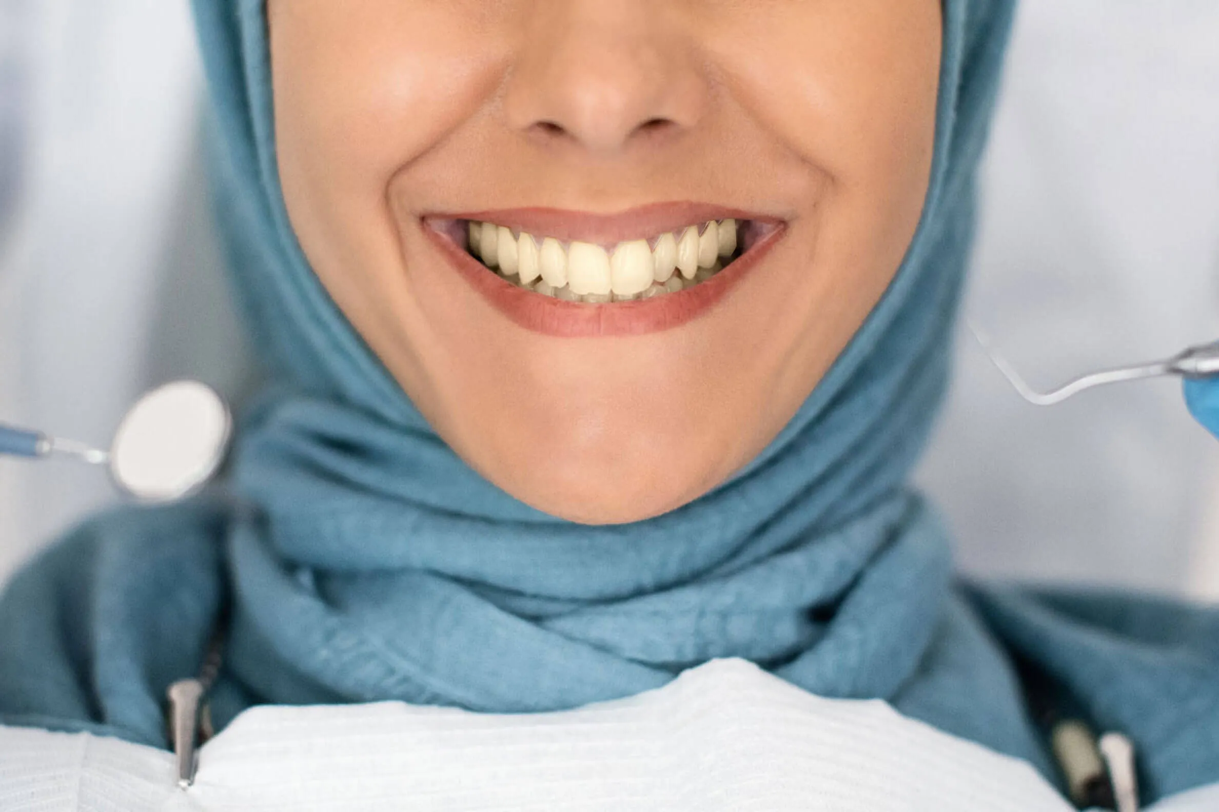 Aspire Dental Spa before and after result