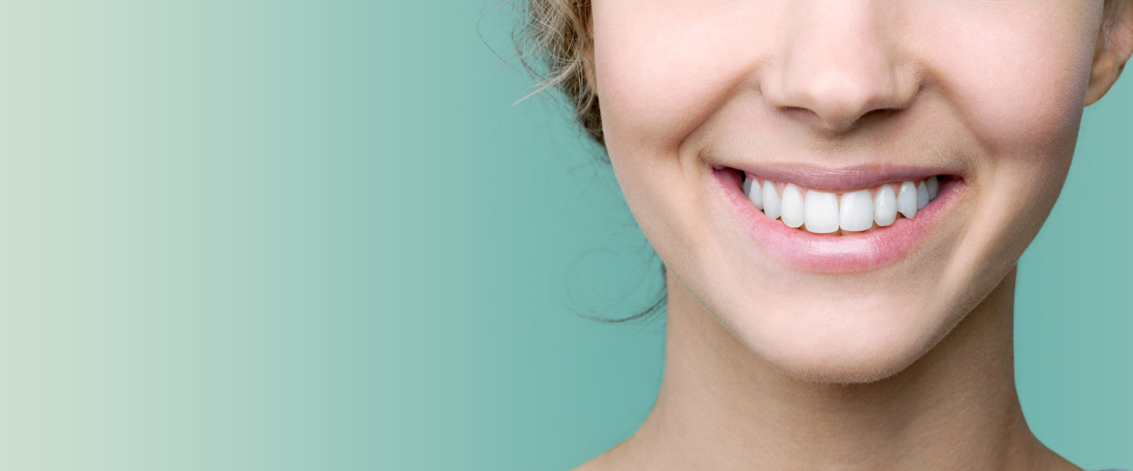Dental Veneers in Beachwood, OH: How Natural-Looking Smile Changes Are Planned